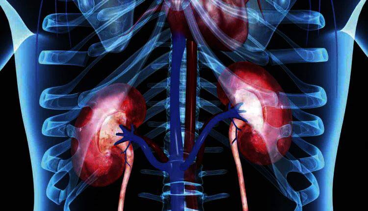 علت، علائئم و راه های درمان از کار افتادن کلیه