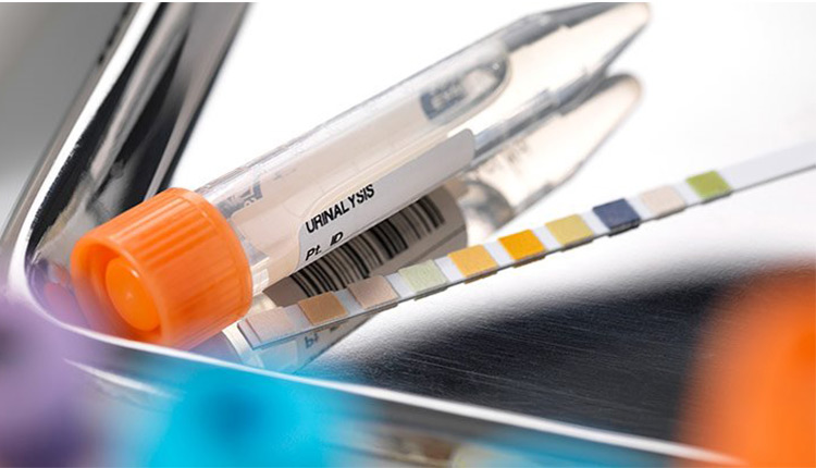 پروتئین در ادرار