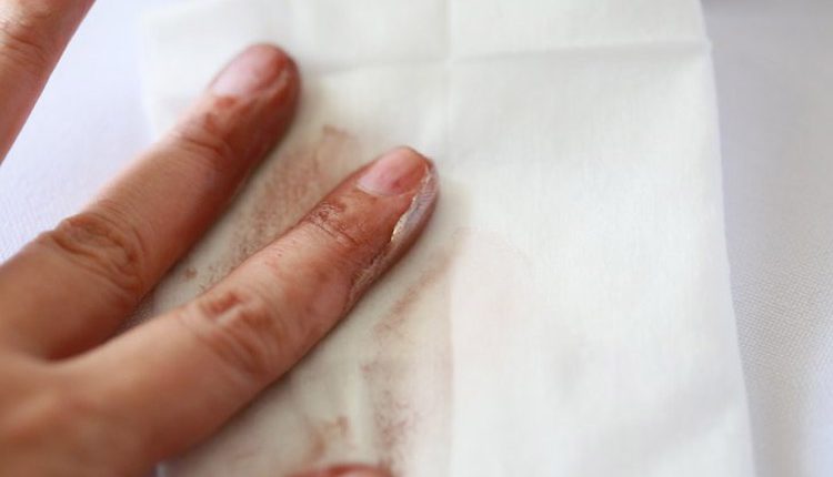 پاک کردن رنگ مو از دست