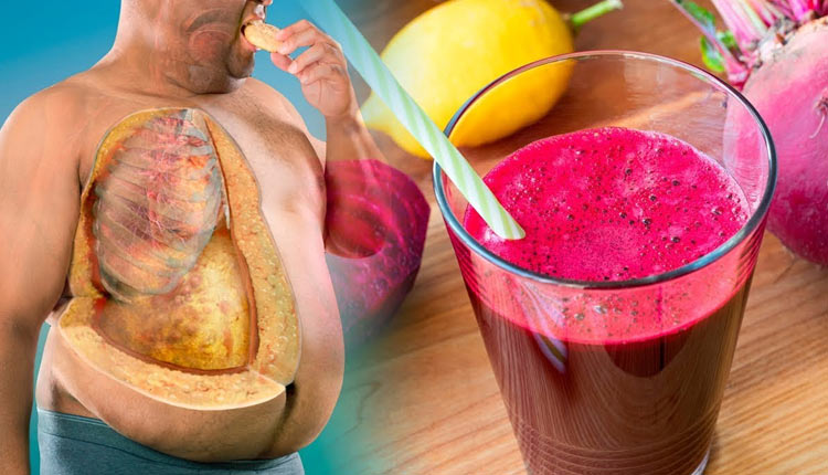 درمان کبد چرب با چغندر