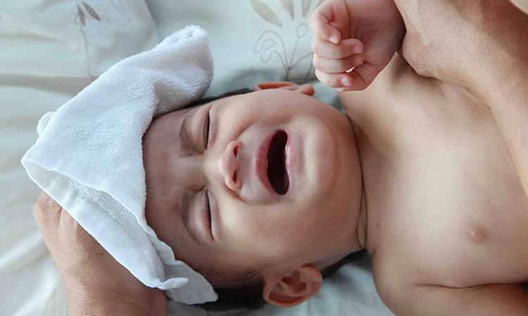 روش‌های پیشگیری و درمان تعریق نوزادان