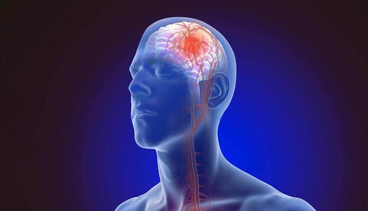 جلوگیری از سکته مغزی با مصرف گندم سبوس دار