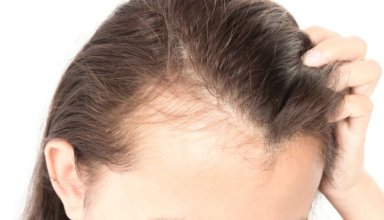 مصرف میگو یک درمان آسان برای ریزش مو