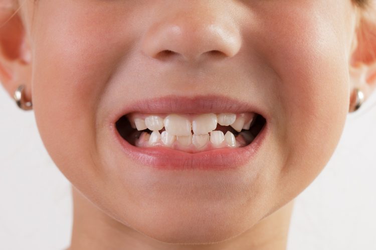 افزایش سلامت دهان و دندان با خوردن آبغوره