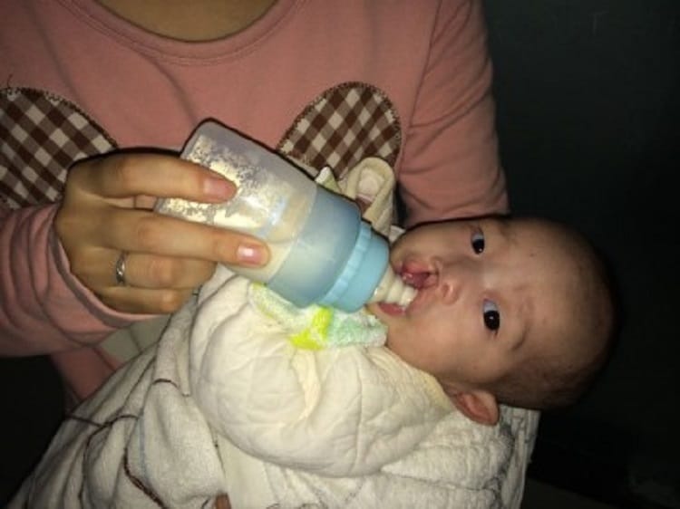 شیر دادن با شیشه مخصوص به نوزاد لب شکری