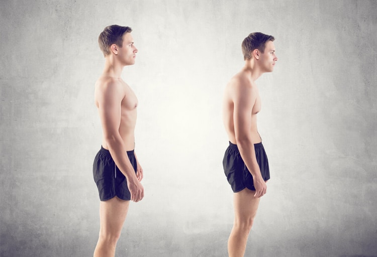 اصلاح قوز کردن