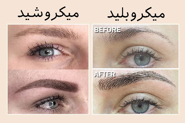 فیبروز و شیدینگ ابرو چیست