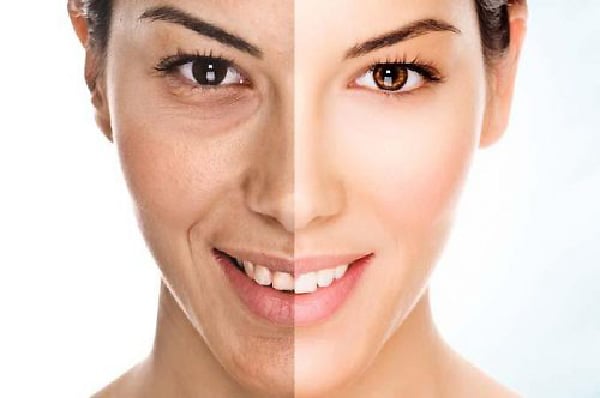 ماسک سفید کننده پوست تاثیر به صورت فوری